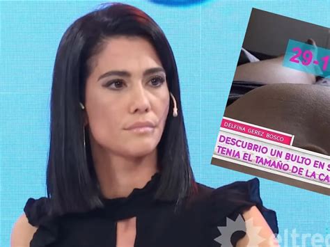 El Drama De Delfina Gerez Bosco Cont Que Le Quitaron Un Tumor De