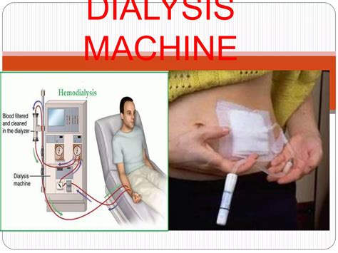 Dialysis machine (2) | PPT