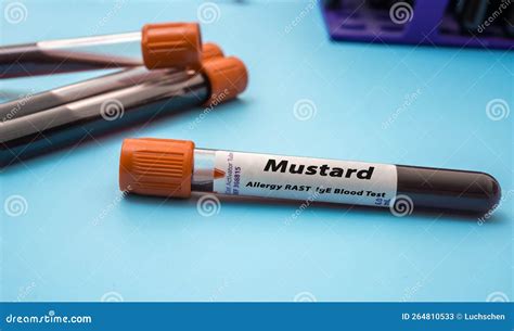 Mustard Allergy RAST IgE Blood Tests. Test Tube on Blue Background ...