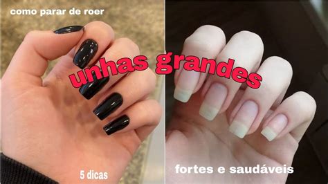 Como parar de roer suas unhas e deixá las fortes e saudáveis DICAS