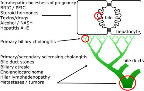 Hepatobiliary Diseases Associated With Cholestatic Pruritus Modified