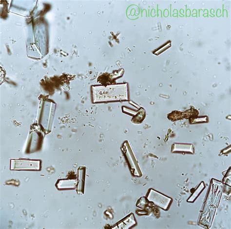 Magnesium Phosphate Crystals