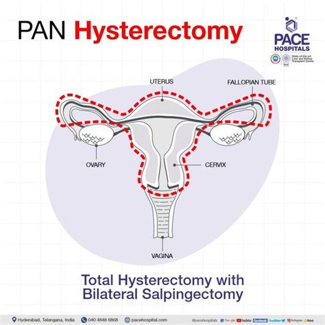 Robotic Assisted Laparoscopic Total Abdominal Hysterectomy Code At