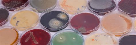 Microbiology Minor : Microbiology: Undergraduate: Department of Biology ...