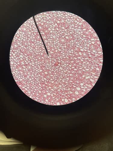 Epithelial Tissue Identification Flashcards Quizlet