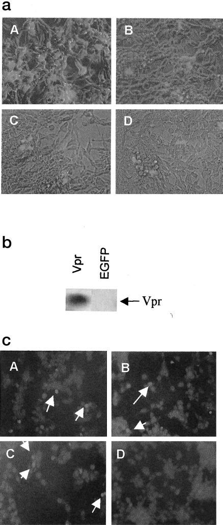 Egfp And Vpr Lentiviral Vector Treatment Of At 84 Cells In Vitro A