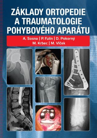 Základy ortopedie a traumatologie pohybového aparátu najlacnejšie