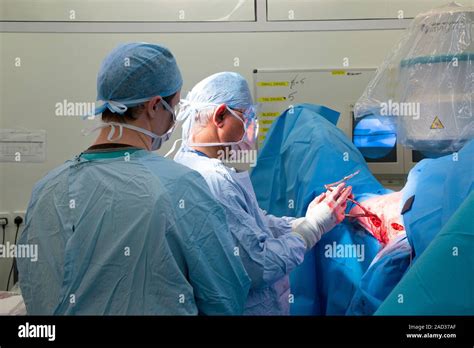 Une Chirurgie Le F Mur Fractur Les Chirurgiens L Exercice De La