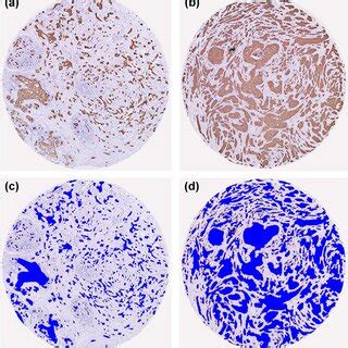 Representative Ihc Staining Image And The Corresponding Segmented Image