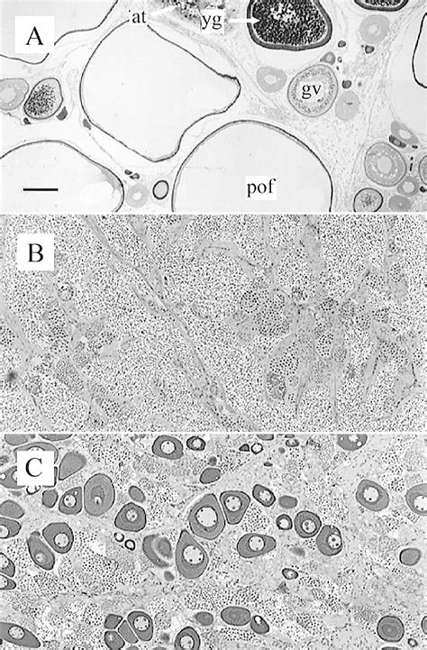 Photomicrographs Of Some Histological Stages Of Gonadal Maturation In