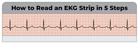 How To Read An EKG Strip In Steps CardiacDirect