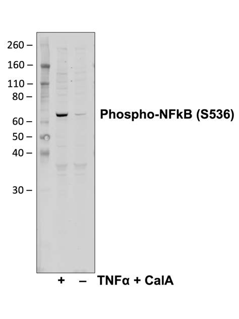 Phospho NFkB P65 S536 Recombinant MAb Abwiz Bio