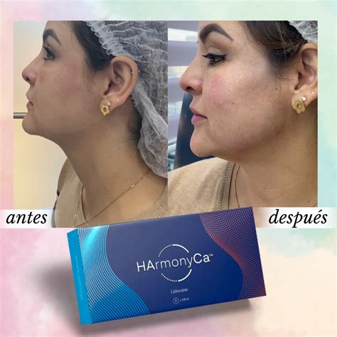 HArmonyCa 1 kit EO Clínica Medicina Estética y Regenerativa en