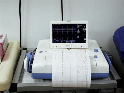 Cardiotocography Device Placed On Mother S Abdomen Recording The Fetal