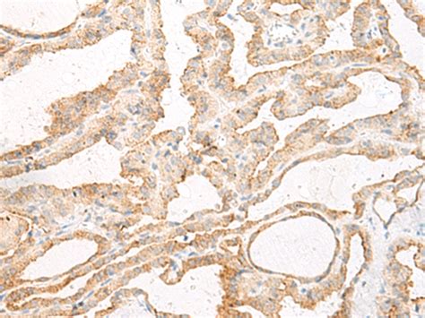 Gls Anti Gls Rabbit Polyclonal Antibody