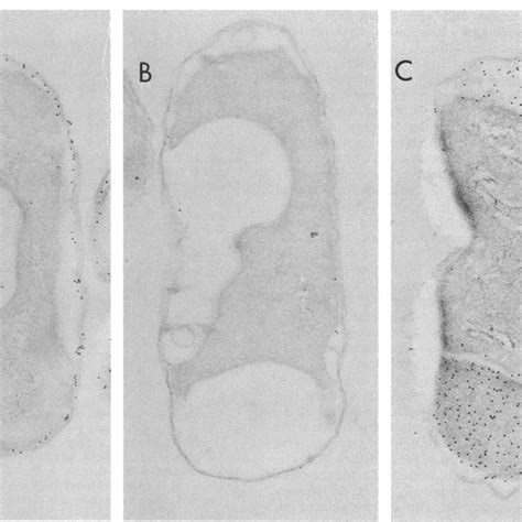 Immunoelectron Microscopic Localization Of The Ompa A Protein A