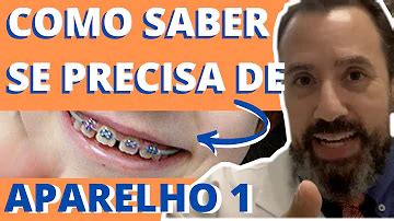 Quem Não Pode Colocar Aparelho Nos Dentes - Como saber se precisa ou não usar aparelho nos dentes?