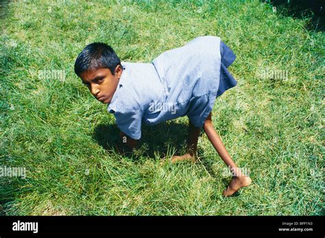 Poliomyelitis Child Hi Res Stock Photography And Images Alamy