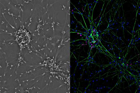 Human Epithelial Cells Light Microscope