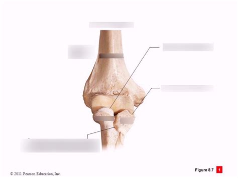 Basic Procedures Chapter 4 Elbow Joints Diagram Quizlet