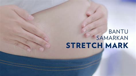 Manfaat Jelly Samarkan Stretch Mark Pada Kulit Youtube