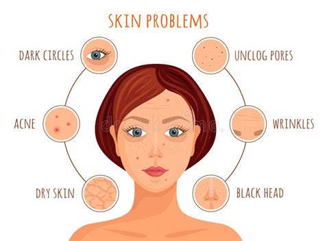 Face Skin Problem Stock Illustrations 7 866 Face Skin Problem Stock