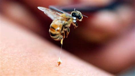 Cómo Tratar Una Picadura De Abeja Cerca Del Ojo Clinica De Ojos Dr