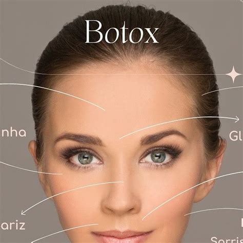 Dra Luane Arciero • Botox Lips On Instagram Botox E Suas Indicações Muitas Pessoas Ainda