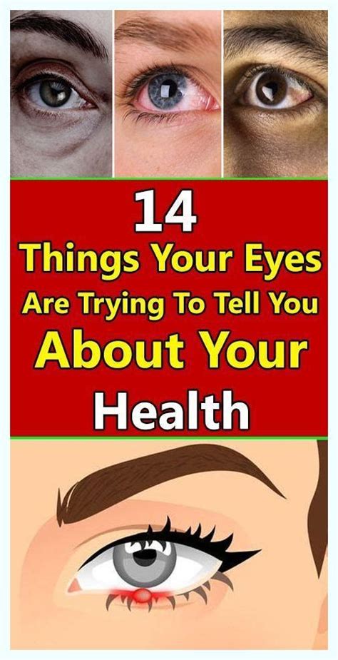 14 Things Your Eyes Are Trying To Tell You About Your Health Artofit