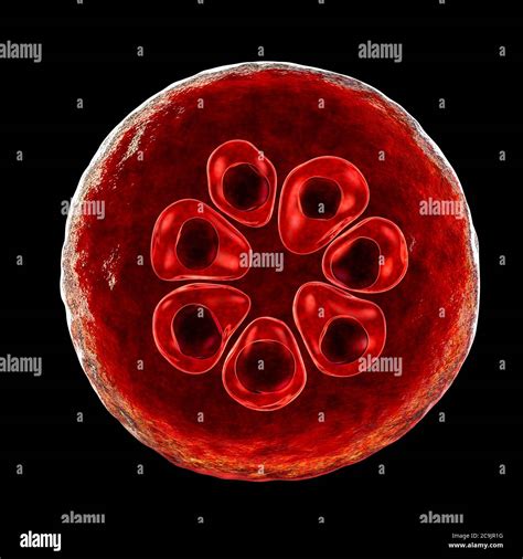 Plasmodium Malariae Protozoan Dentro De Los Glóbulos Rojos Ilustración Por Computadora P