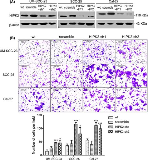 Attenuated Homeodomain‐interacting Protein Kinase 2 Hipk2 Expression