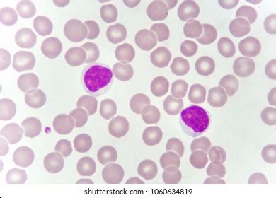 Lymphocyte Cells White Blood Cell Blood Stock Photo 1060634819 ...