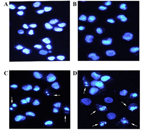 Morphological Observation Of Apoptosis In Gemini Cur Treated Cells By