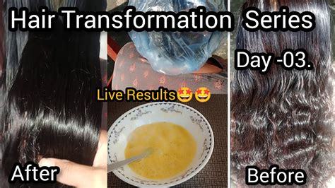 6 Days Hair Transformation Series Fix Extreme Thin Dry Damage Hair To