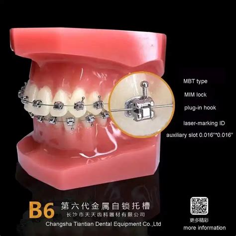 Orthodontic Band Orthodontic Brackets Mbt System Oral Braces Self