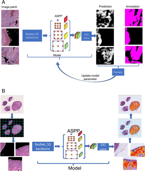 Automatic Detection Of Squamous Cell Carcinoma Metastasis In Esophageal Lymph Nodes Using