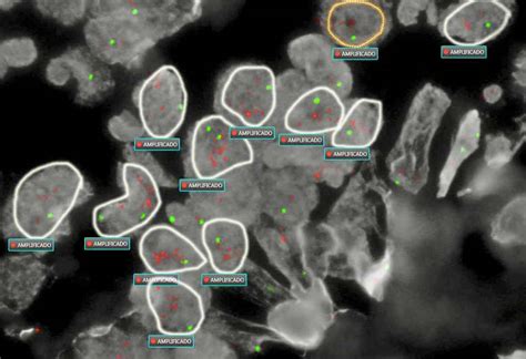 Bacteri Fagos Los Virus Que Infectan Bacterias Y Sus Usos En Medicina