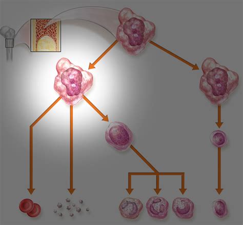 Types of Leukemia and Their Treatment | Cancer Patient Resource Center