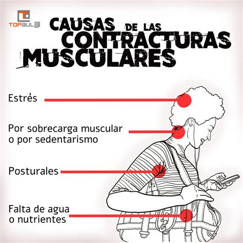 Por qué sufrimos contracturas musculares TOP aul