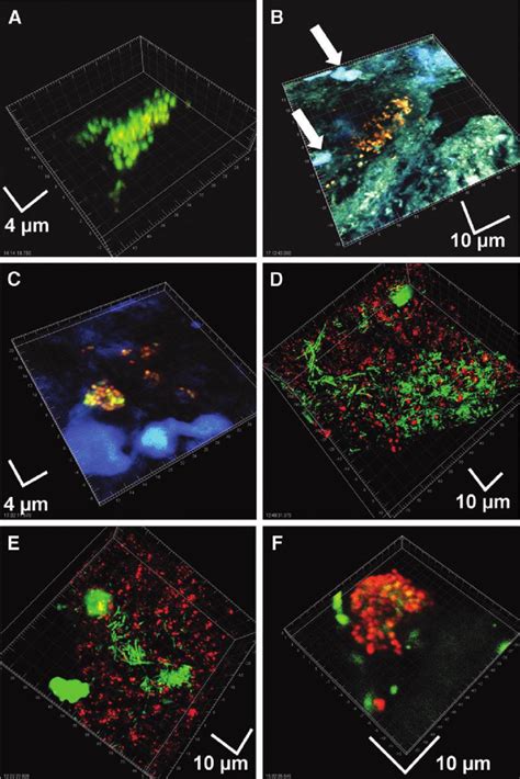 Fluorescence In Situ Hybridization Fish Imaging Of Mesh And Tissue