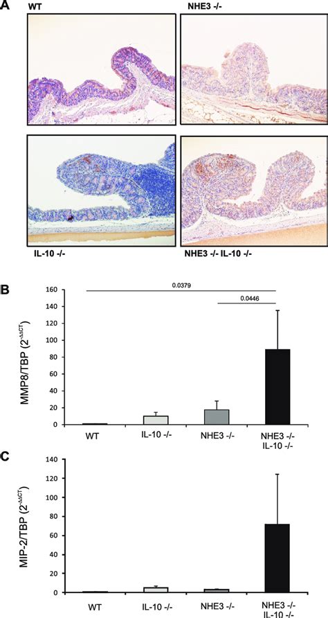 Neutrophilic Infiltration And Macrophage Inflammatory Protein MIP 2