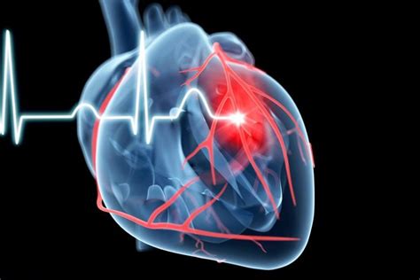 Work Stress Linked To A 97 Increased Risk Of Irregular Heart Rhythm