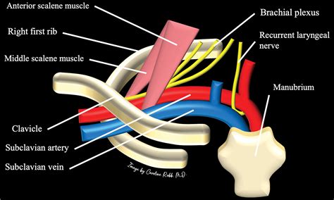 Subclavian Artery Anatomic Review And Imaging Evaluation Of Abnormalities Radiographics