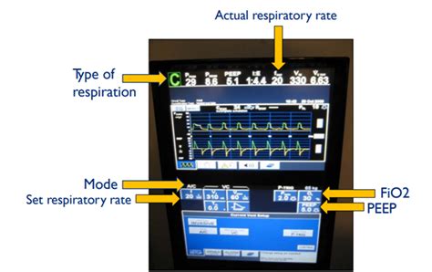 Mechanical Ventilation The Basics Covid 19 Curriculum