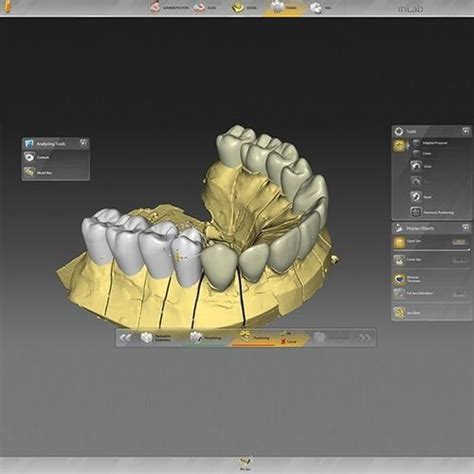 Software Para Laboratório De Prótese Dentária Inlab Dentsply