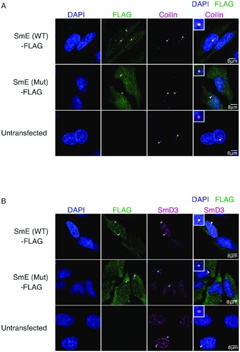 NSM Mutation Causes Mis Localization Of The SNRPE SmE Protein A B