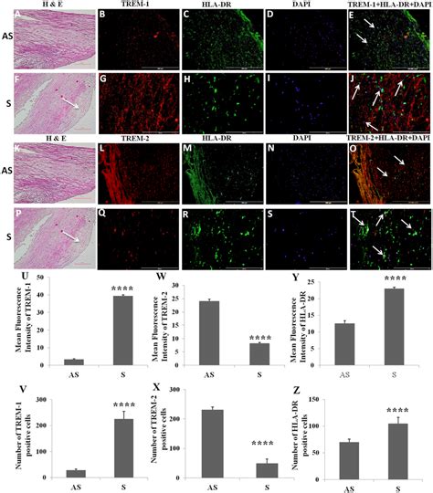 Immunofluorescence Staining For Trem 1 Trem 2 And Hla Dr And