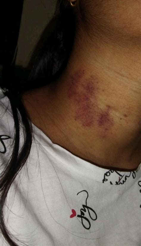 She loves getting hickeys : r/IndianHotwife