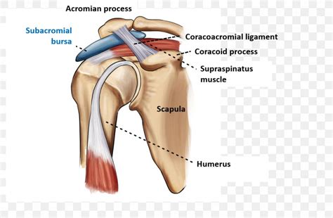 Subacromial Bursitis Shoulder Impingement Syndrome Subacromial Bursa 92820 Hot Sex Picture