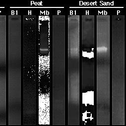 Gel Electrophoretic Separation Of Dna Fragments Obtained By Pcr